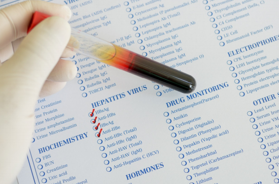 Lab Tests – Urinalysis & Iodine Levels
